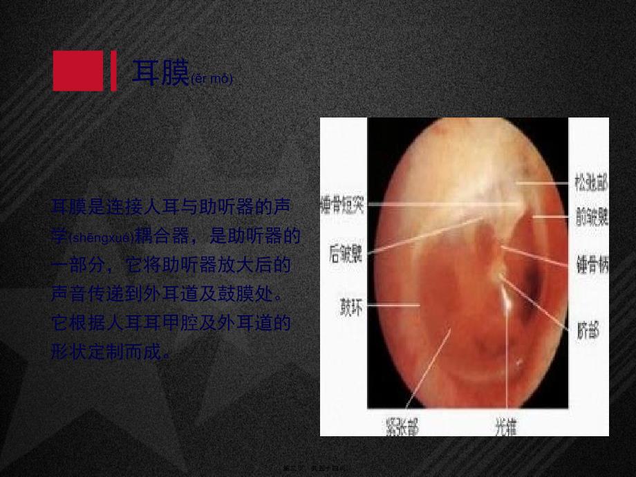 医学专题—耳膜及其声学特性7885_第2页