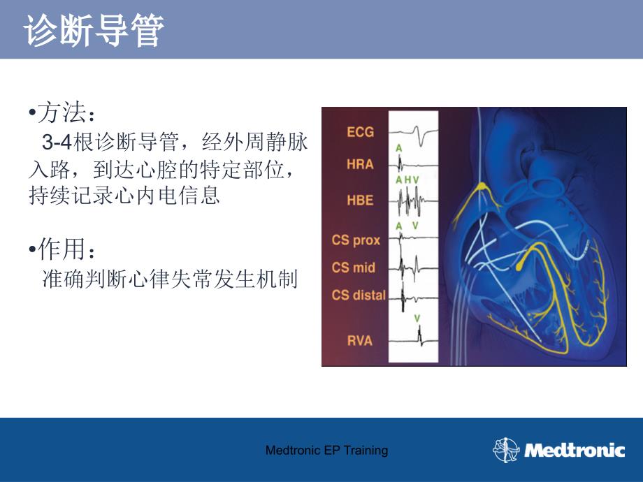 心脏起搏器培训资料：EP products_第4页