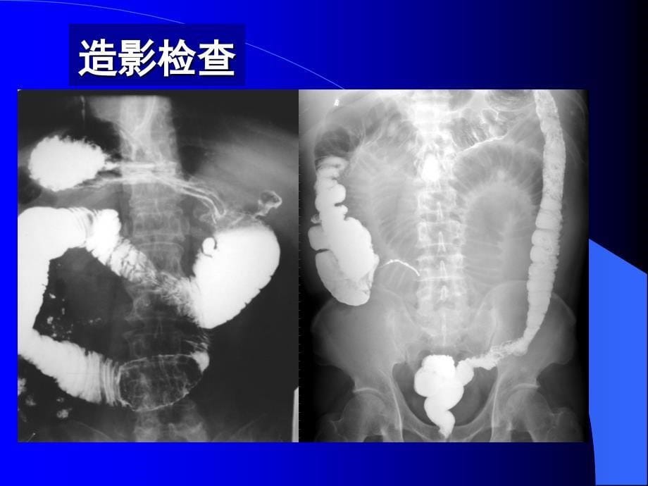 医学影像学：急腹症_第5页