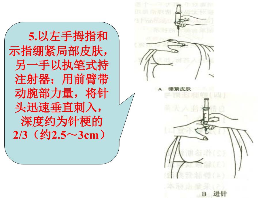 5以左手拇指和示指绷紧局部皮肤-另一手以执笔式持注射器_第2页