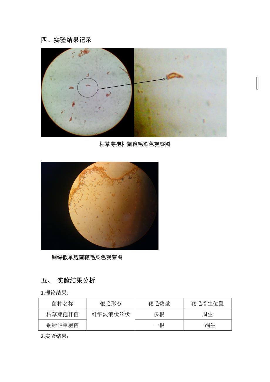 细菌鞭毛染色(精品)_第2页