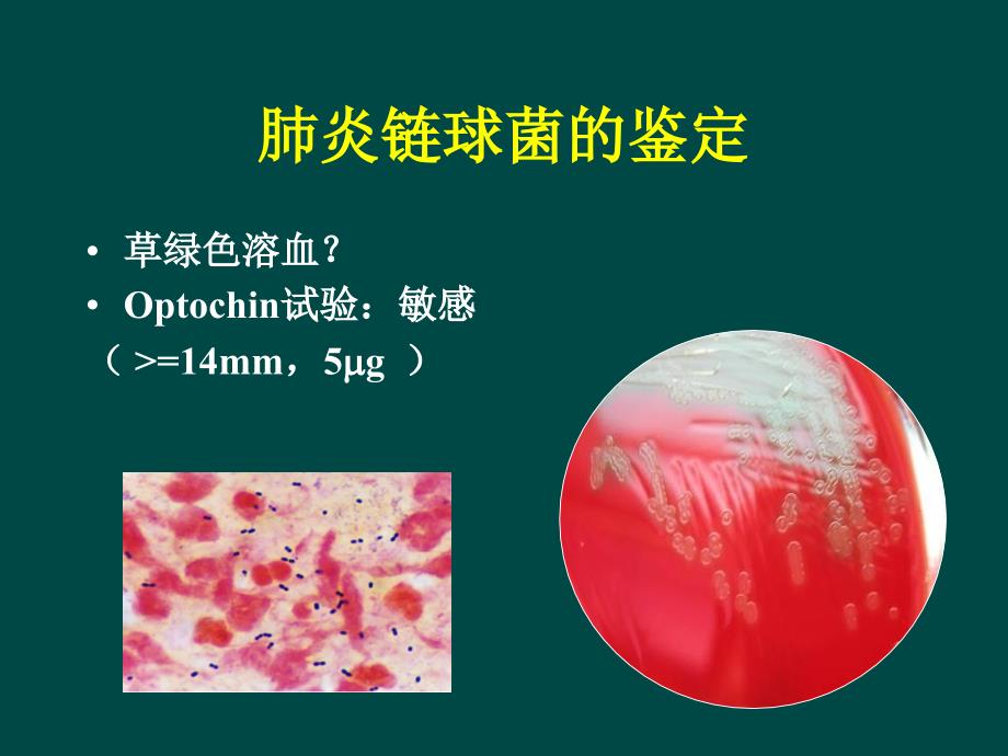 肺部感染的治疗难点：主要耐药菌PRSP、MRSA、MDR－GNB的治疗_第4页