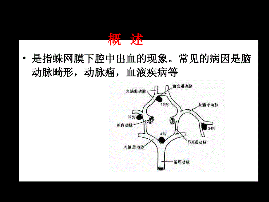 蛛网膜下腔出血病人的护理ppt课件_第4页