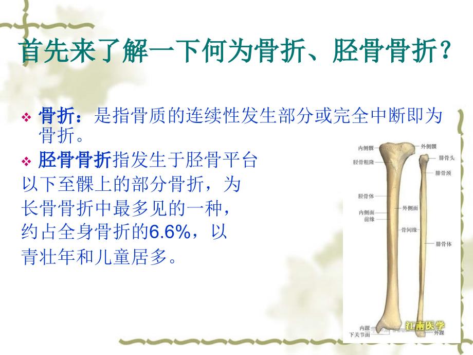 胫骨骨折的护理查房演示文稿课件_第2页