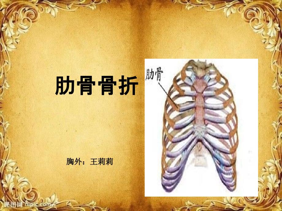 肋骨骨折讲课PPT课件_第1页