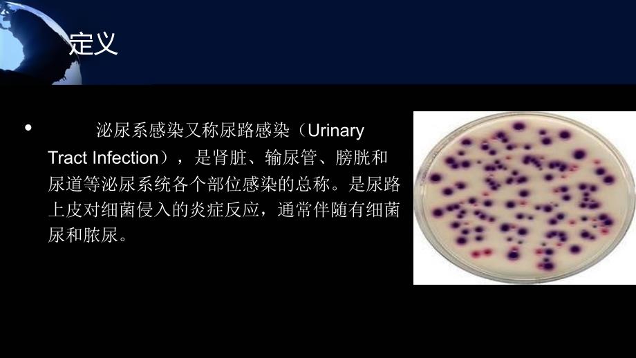 医学专题：单纯性尿路感染_第2页