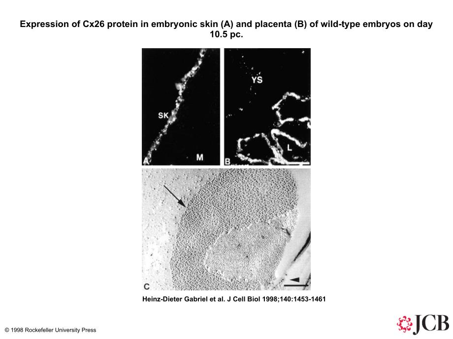 ExpressionofCx26proteininembryonicskinAand_第1页