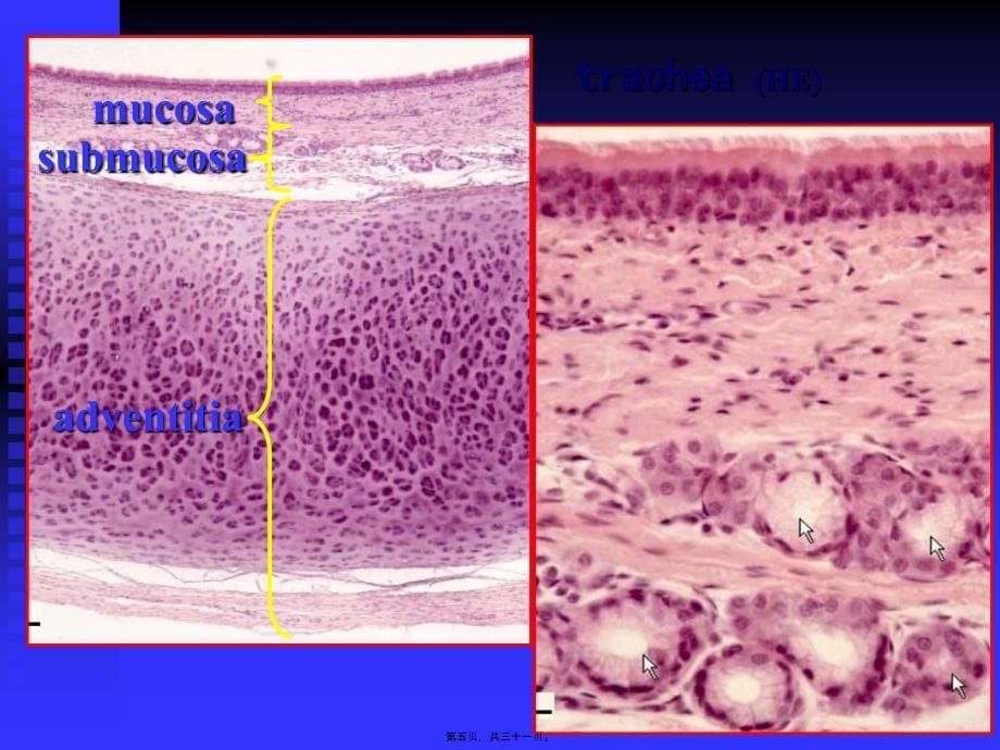 医学专题—呼吸系统--组织学和胚胎学12487_第5页