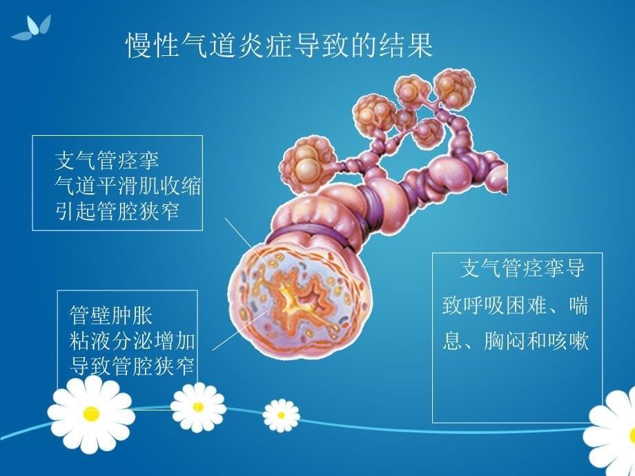 儿童哮喘防治知识ppt课件_第5页