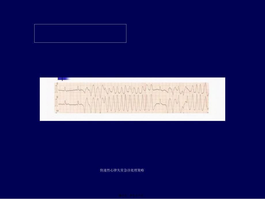 快速性心律失常急诊处理策略课件_第3页