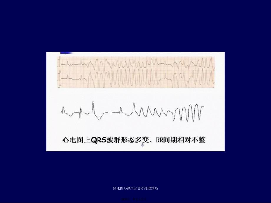 快速性心律失常急诊处理策略课件_第4页