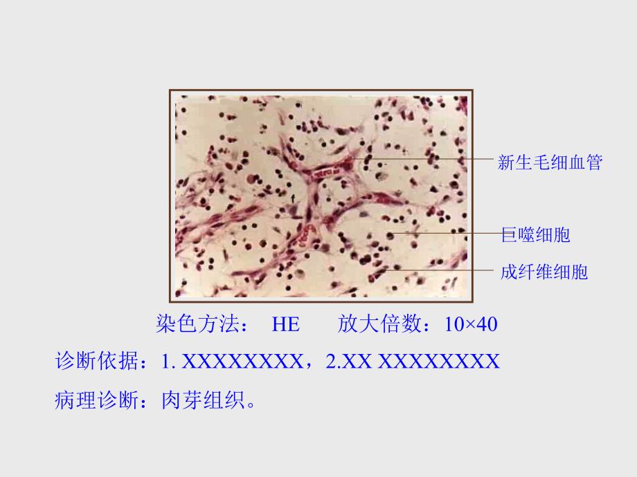 细胞组织的适应损伤与修复实验一文档资料_第4页