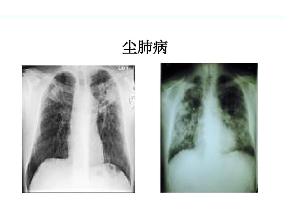 《新职业病防治法》PPT课件_第5页