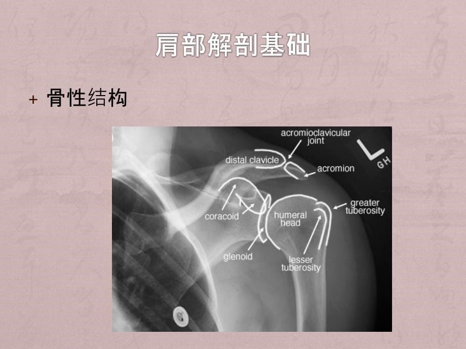 肩膀酸痛与肩周炎课件_第5页