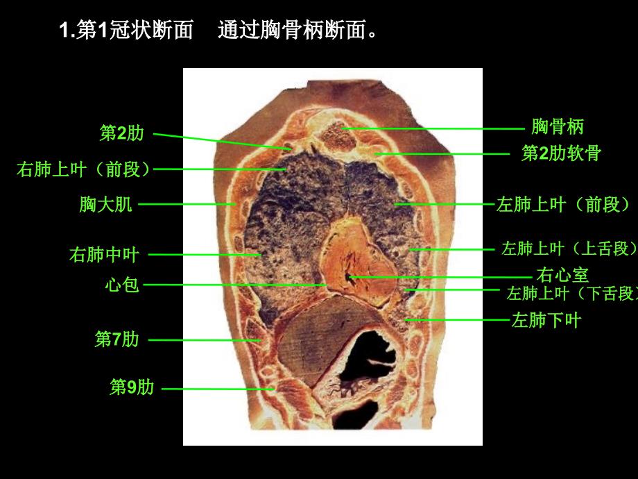 胸部冠矢状断面解剖_第4页