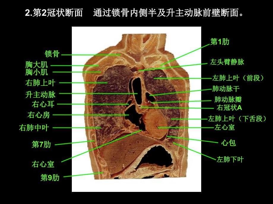 胸部冠矢状断面解剖_第5页