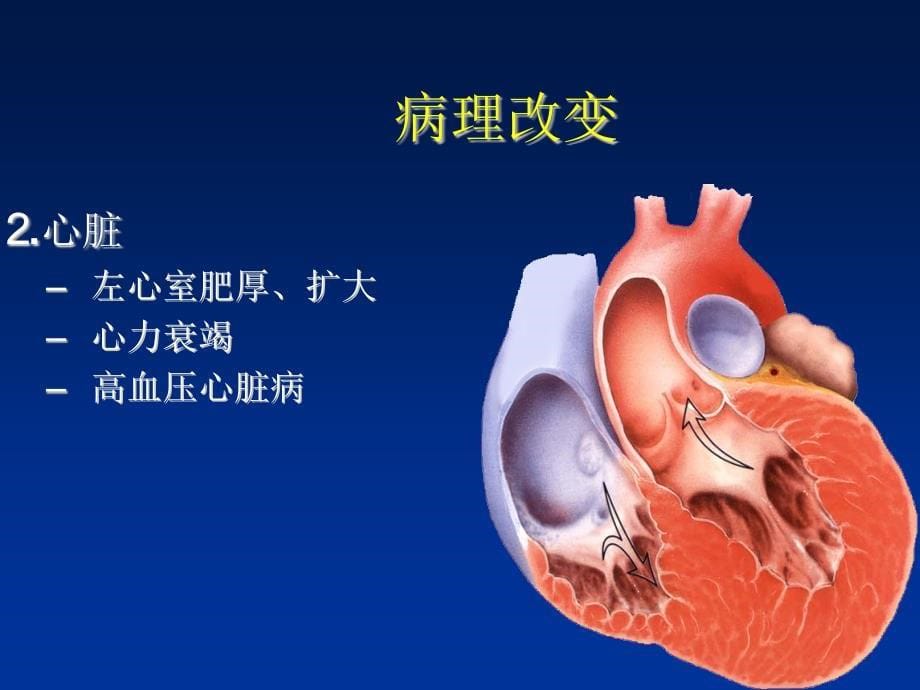 高血压的规范化治疗_第5页