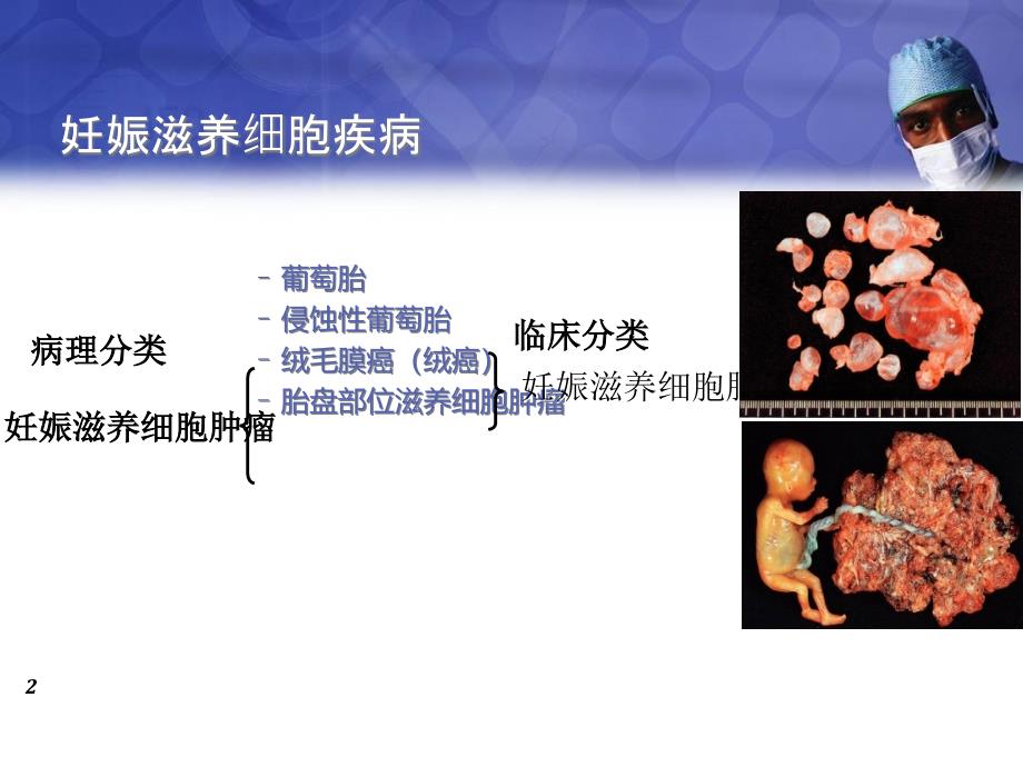 妊娠滋养细胞疾病_第2页