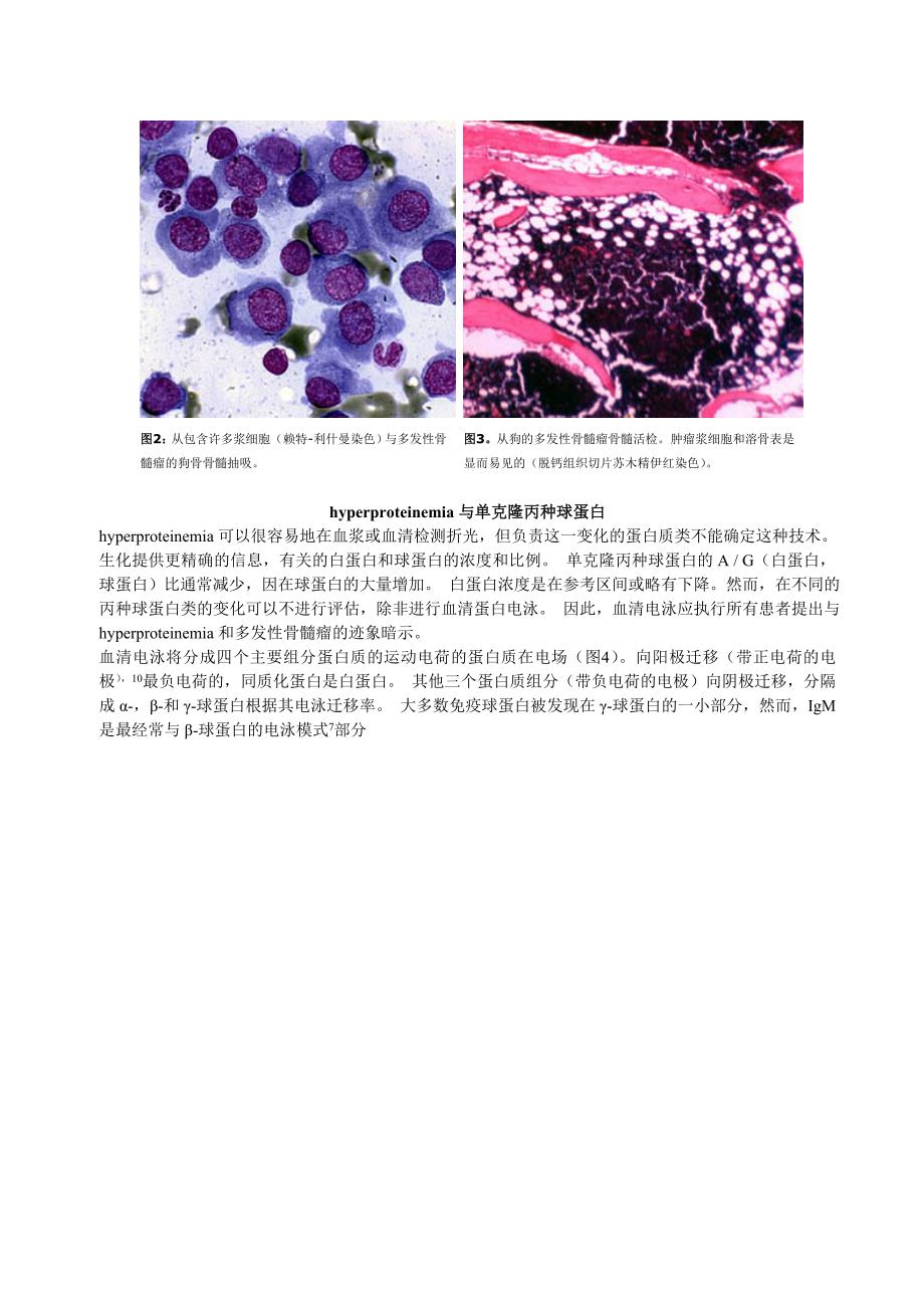 多发性骨髓瘤佘老师_第3页