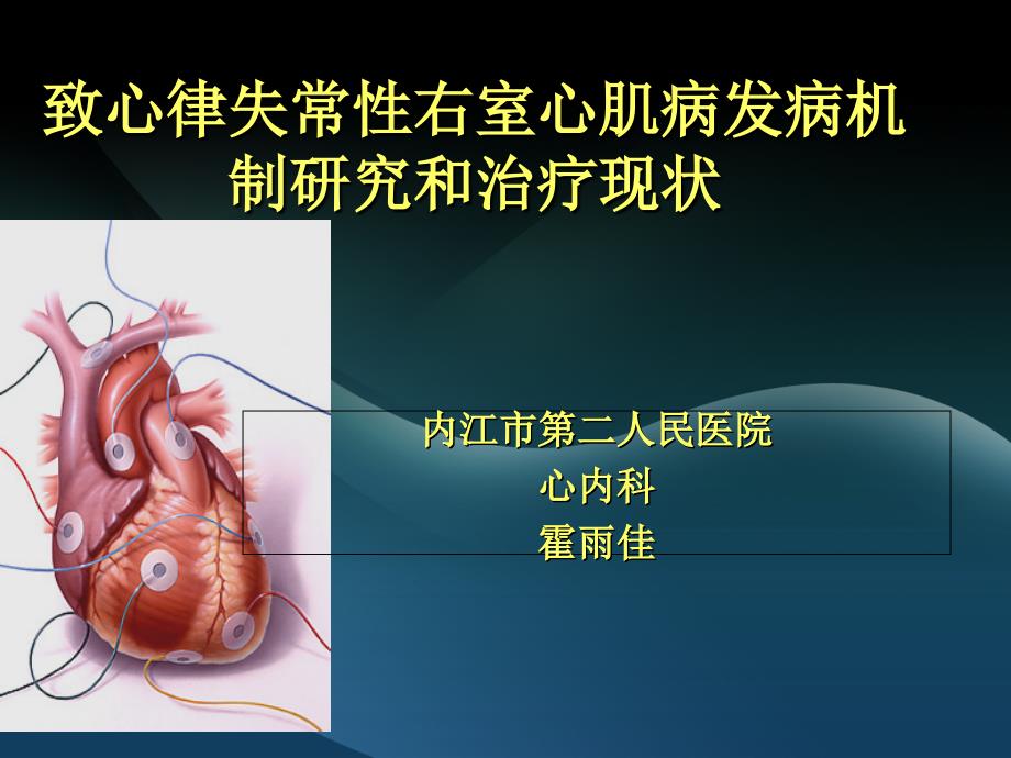 致心律失常性右室心肌病_第1页