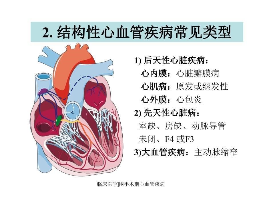 临床医学围手术期心血管疾病课件_第5页