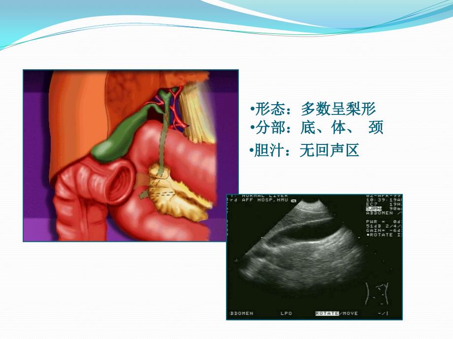 胆道疾病培训课件_第4页