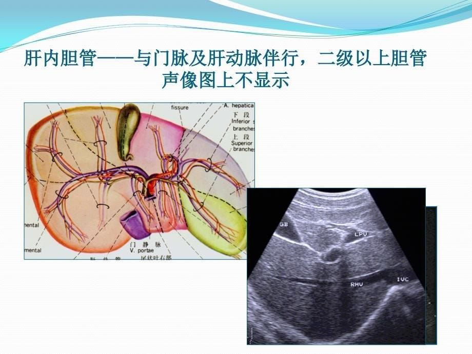 胆道疾病培训课件_第5页