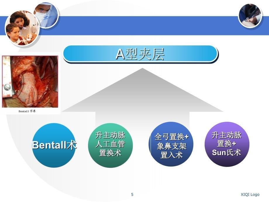 主动脉夹层手术的麻醉_第5页