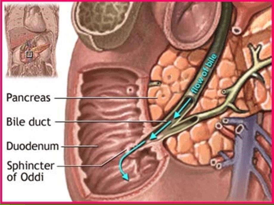 急性胰腺炎病人护理课件1_第5页