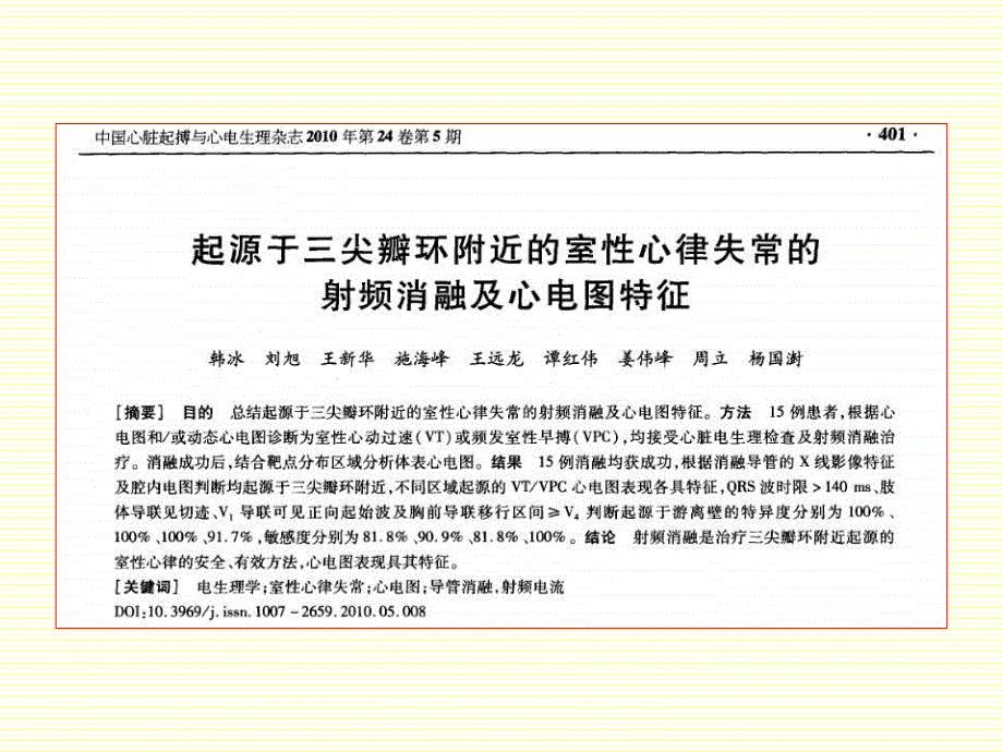 起源于三尖瓣环的室早室速导管消融治疗_第4页