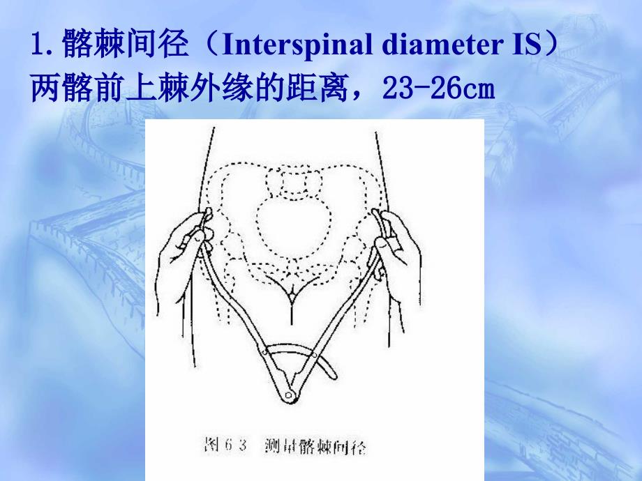 骨盆测量1课件_第3页