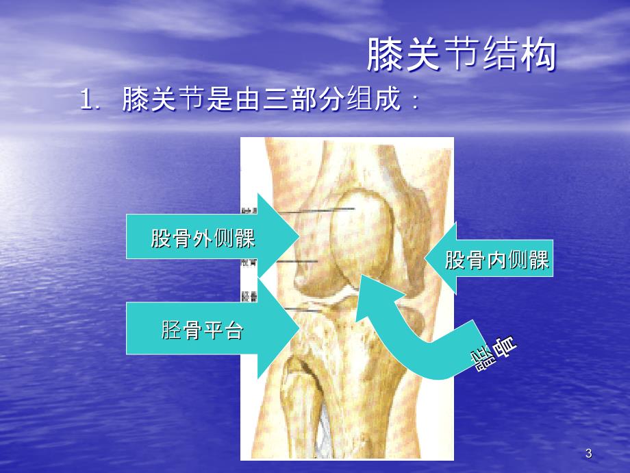 膝骨性关节炎课件_第3页