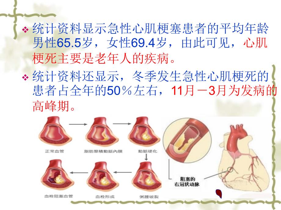 冬季中老年人常见疾病预防及保健_第4页