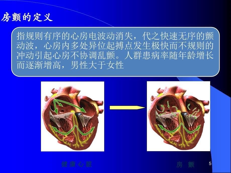 心衰房颤护理查房 ppt课件_第5页