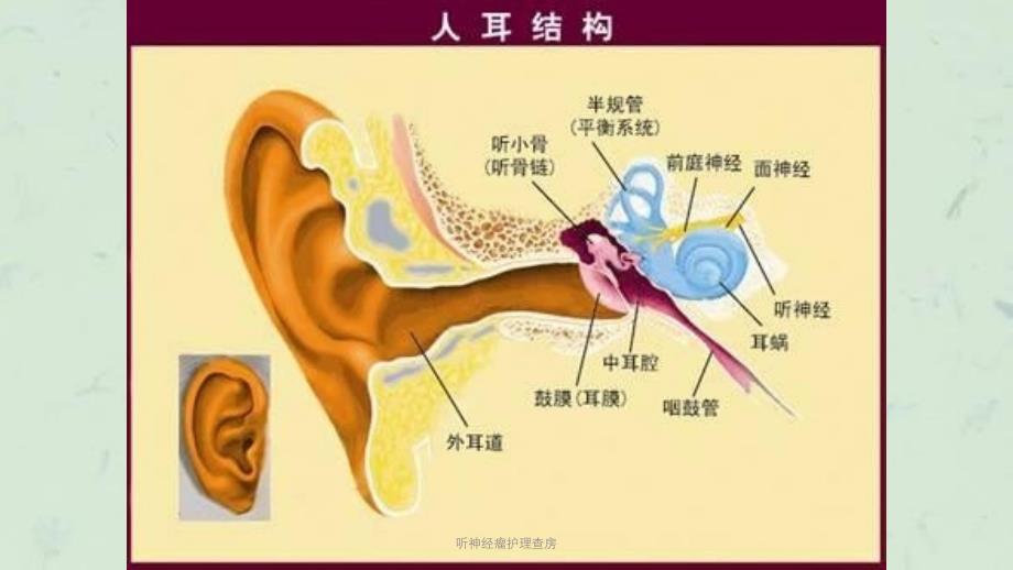 听神经瘤护理查房课件_第3页