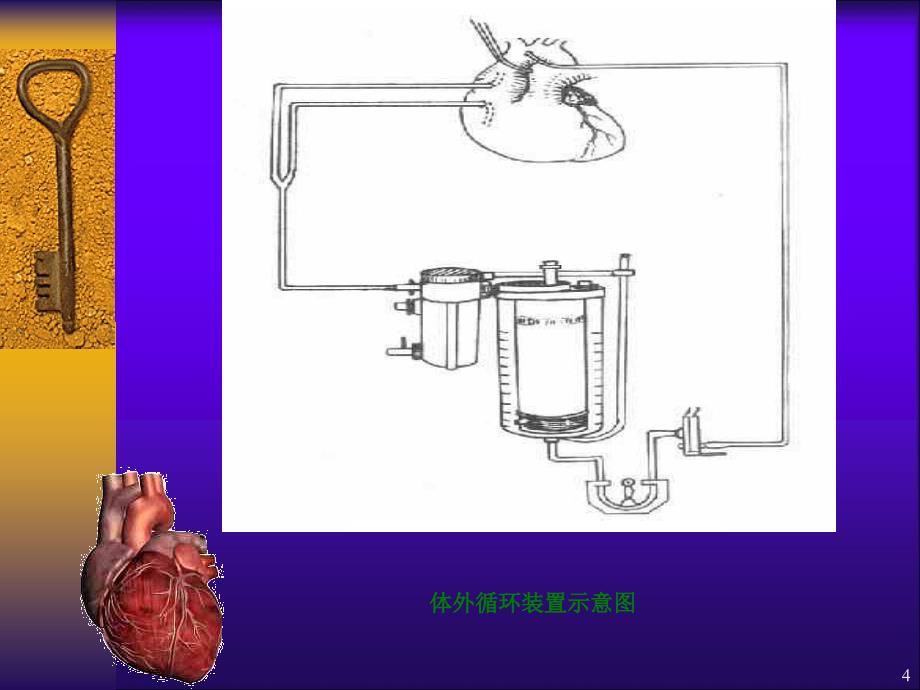 心脏疾病ppt课件_第4页