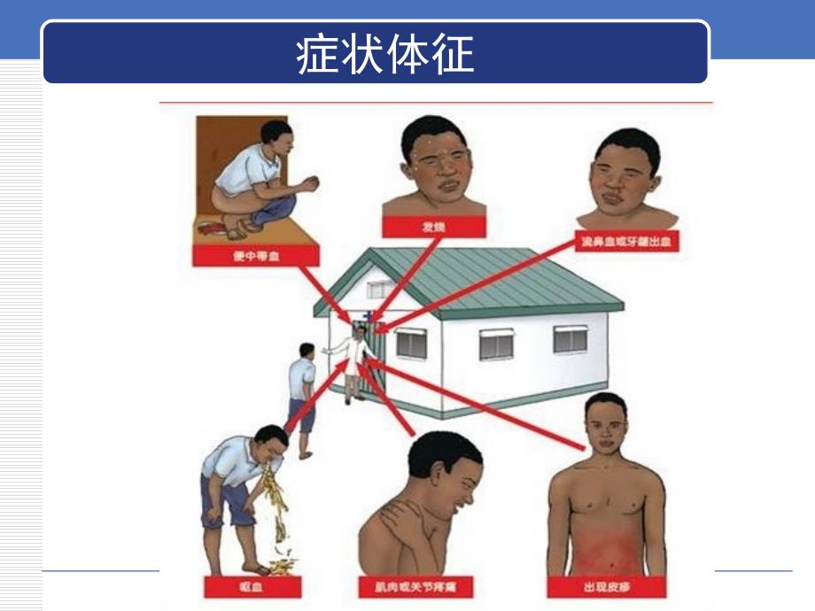 埃博拉出血热医院感染预防与控制_第4页