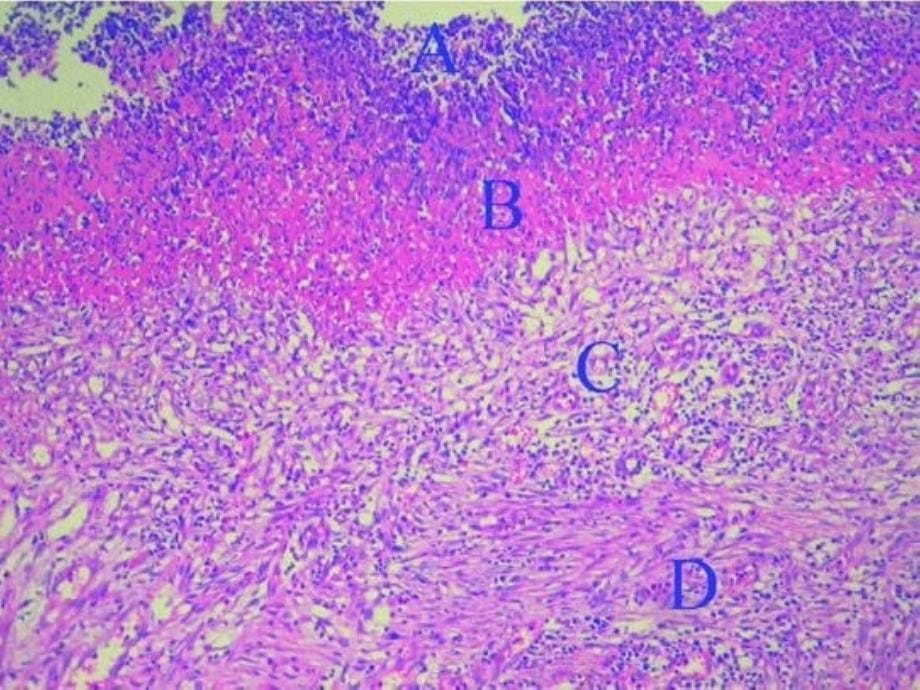 消化、泌尿、传染疾病的病理学实验_第5页