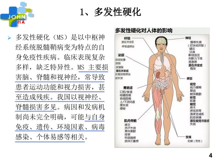 脑脊液寡克隆区带对多发性硬官化的诊断意义傅慧ppt课件_第4页