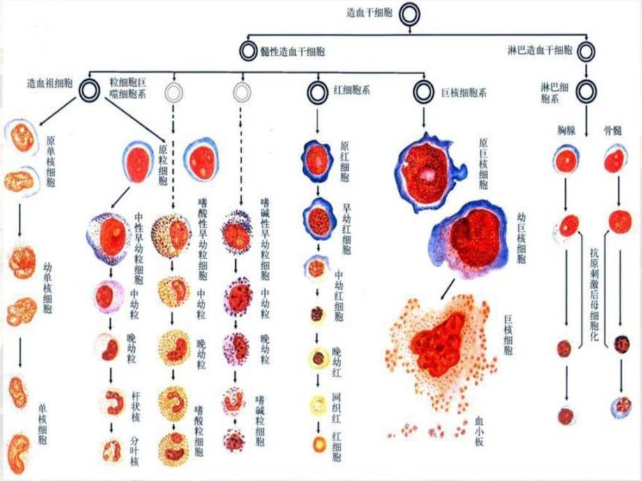 白血病病人的护理图文.ppt_第4页