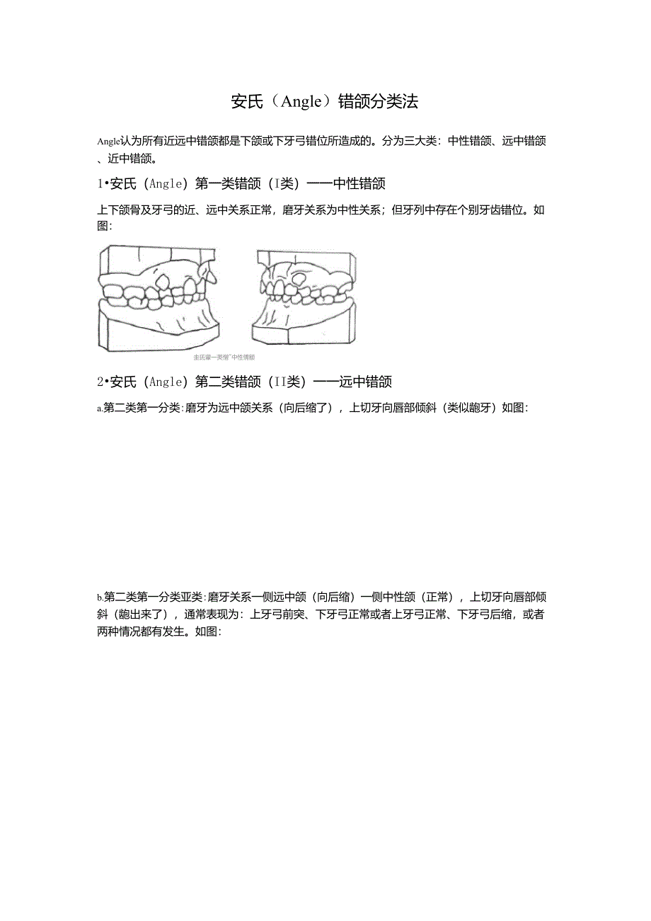 正畸错颌畸形分类图示例_第1页