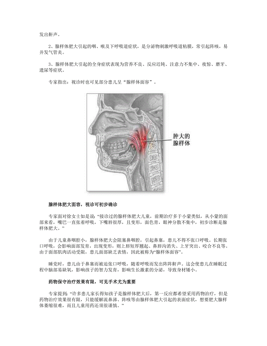 孩子鼻塞流涕警惕腺样体肥大.doc_第2页