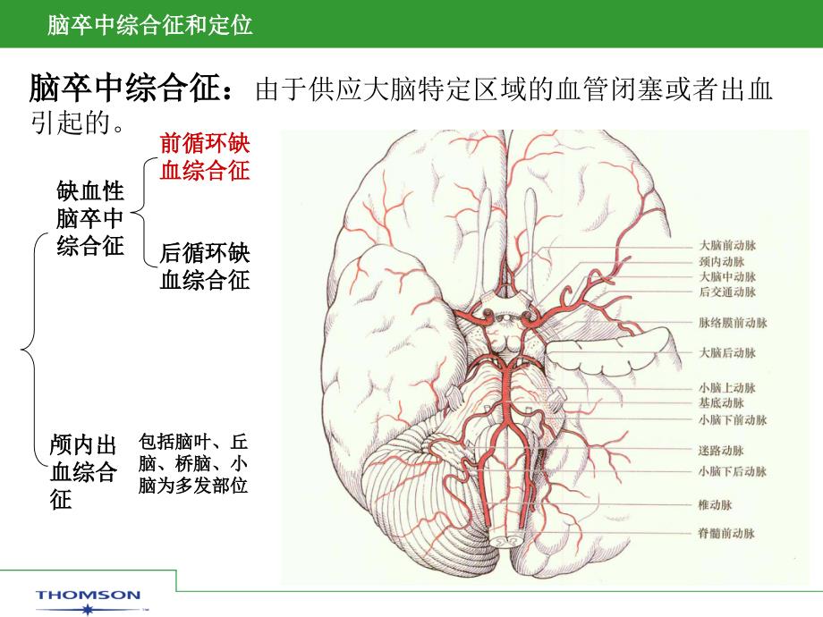 脑卒中综合症和定位课件_第2页