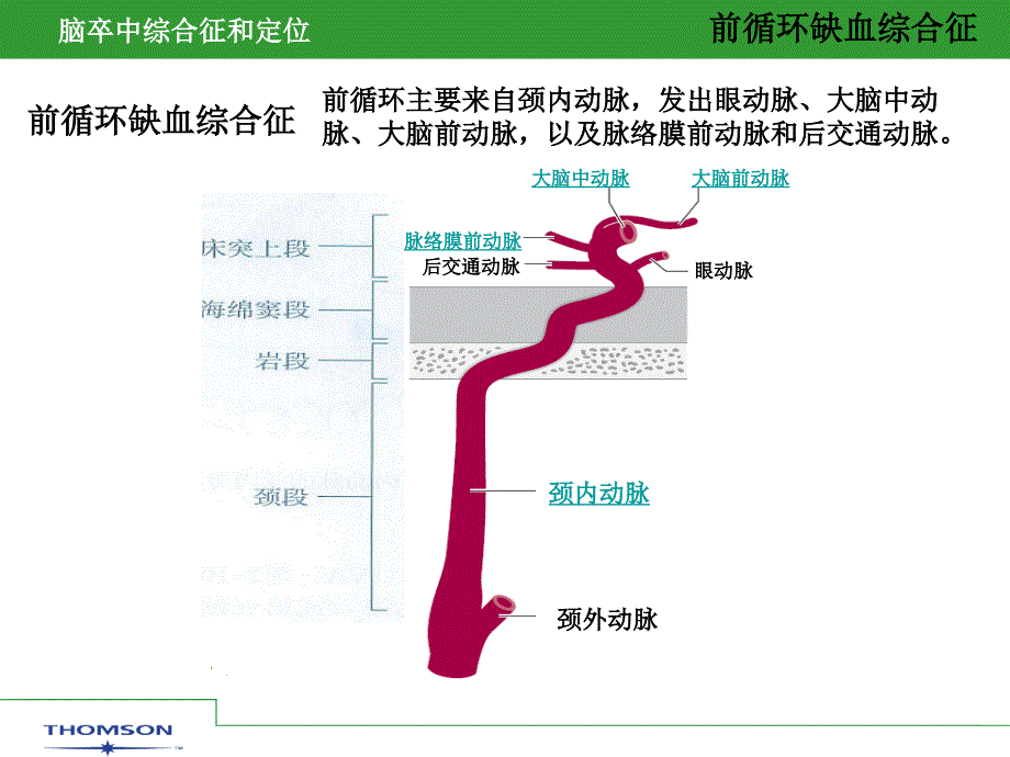 脑卒中综合症和定位课件_第3页