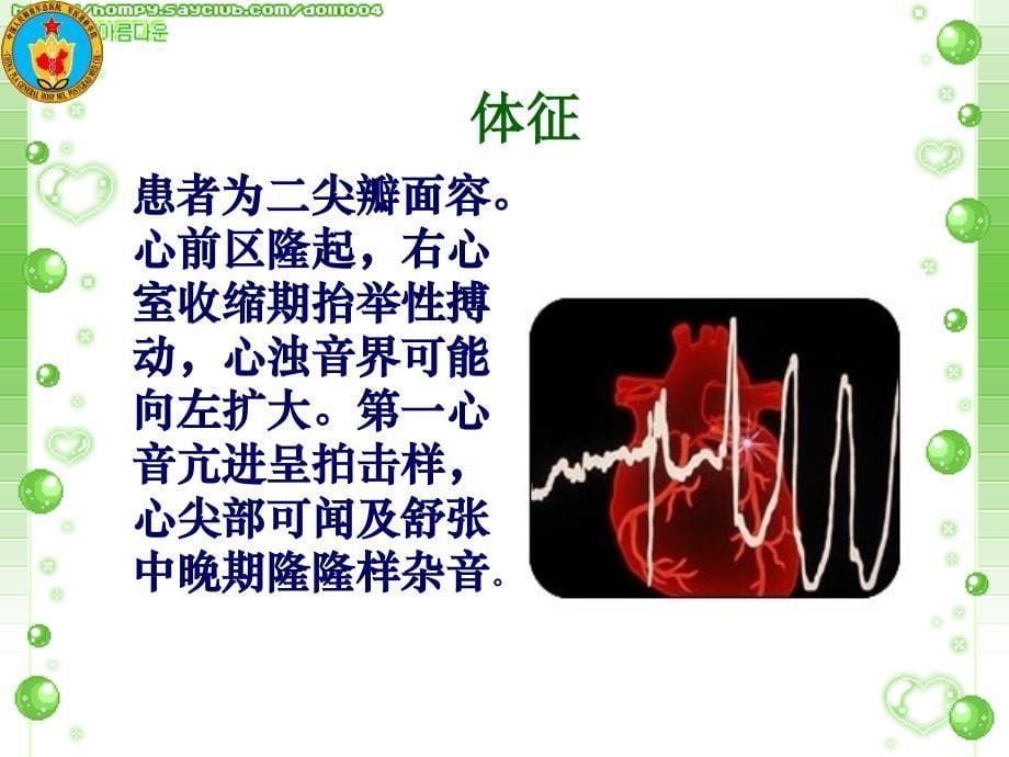 《尖瓣球囊扩张术》PPT课件.ppt_第5页