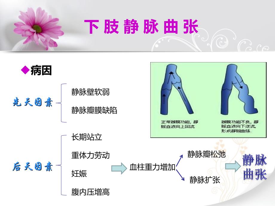 下肢静脉曲张护理查房PPT_第4页