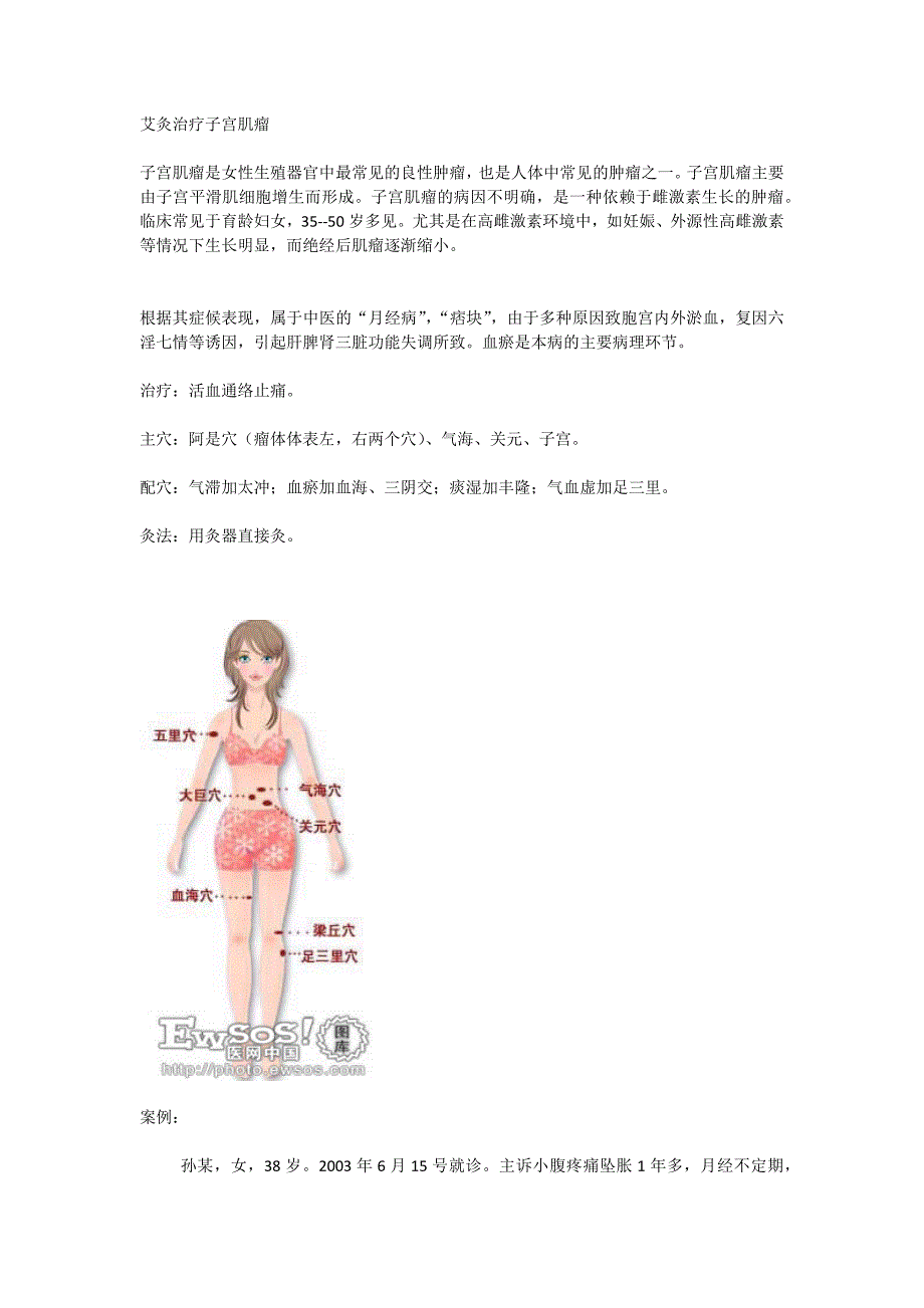 艾灸治疗子宫肌瘤_第1页