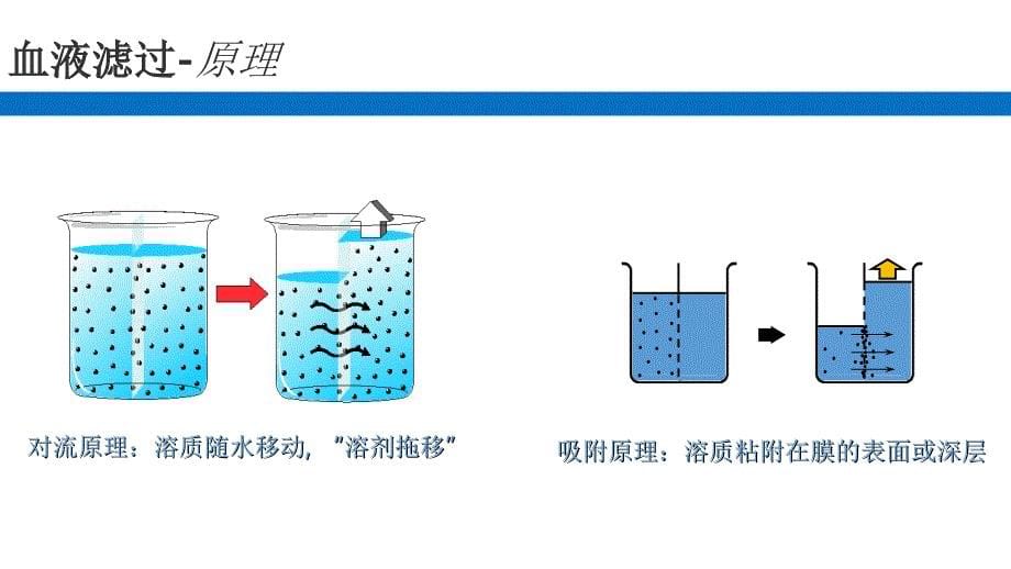 血液净化技术_第5页