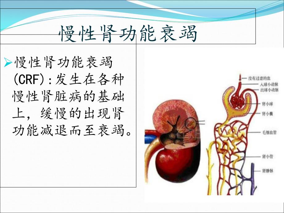 慢性肾功能衰竭护理查房ppt培训课件_第2页