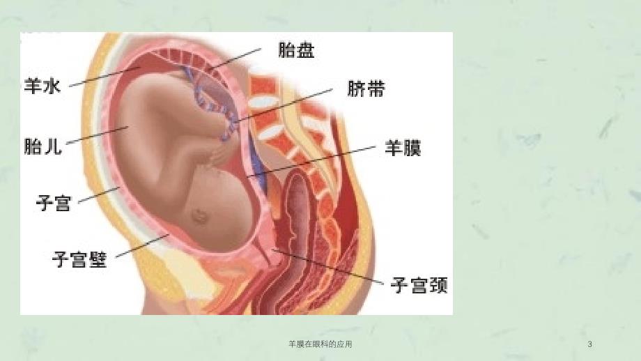 羊膜在眼科的应用课件_第3页